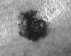 aper�u image memo